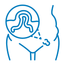 inguinal-hernia-expertise