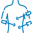 laparoscopy
