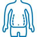 liposuction