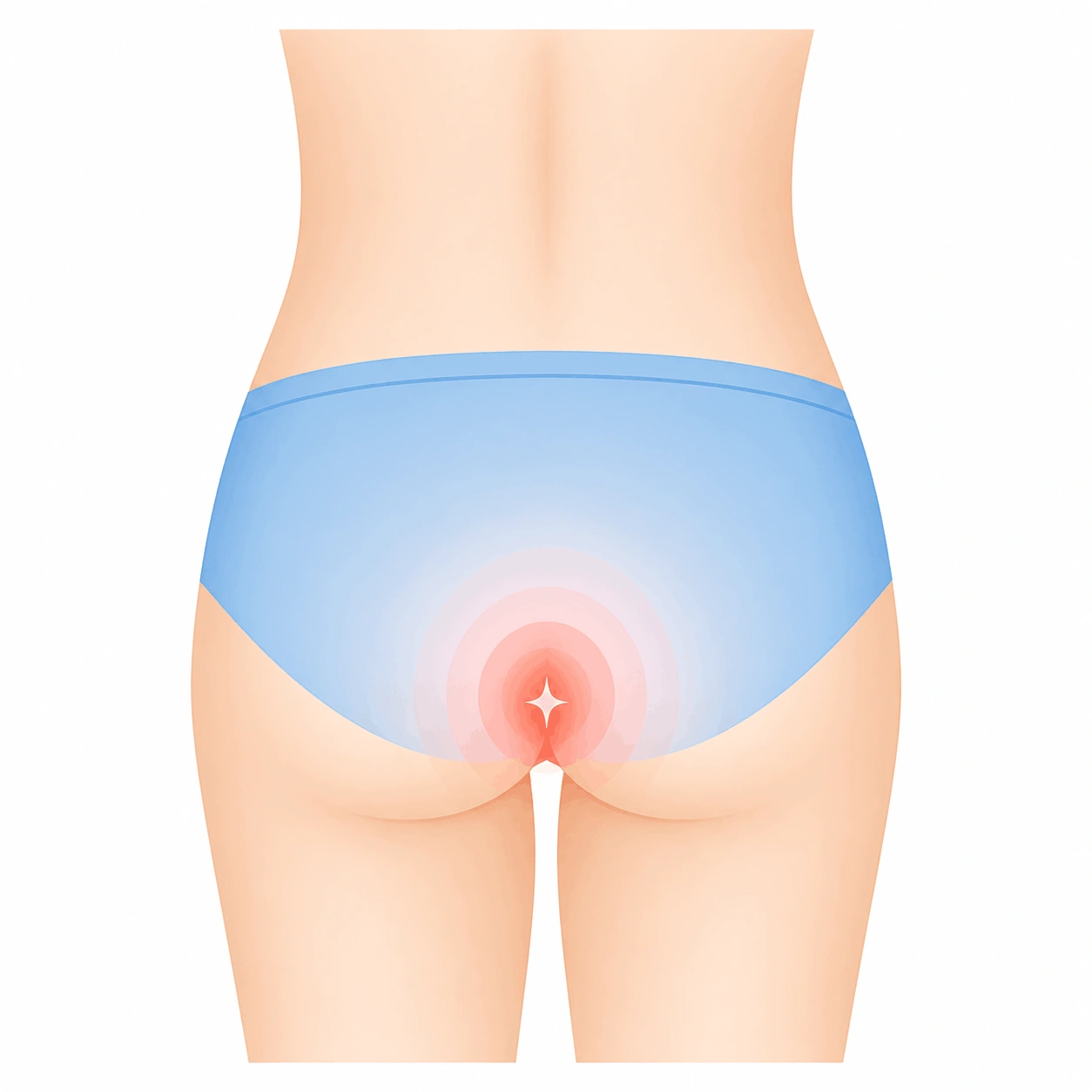 MIRA Healthcare-Anal pain Treatment-image