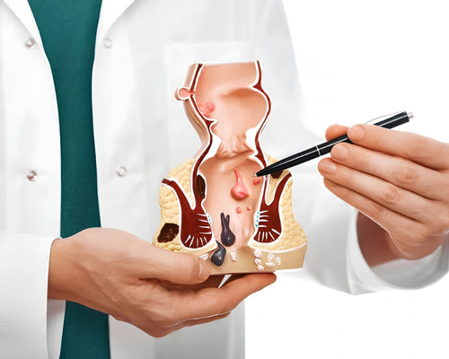 How to Choose the Right Proctologist in Chennai